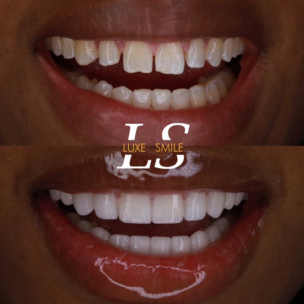 Transformation 02 — before and after