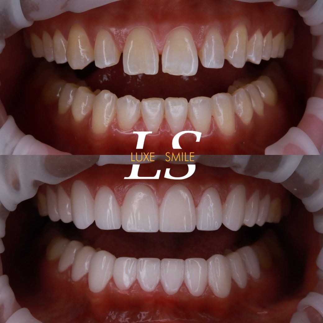 Transformation 03 — before and after