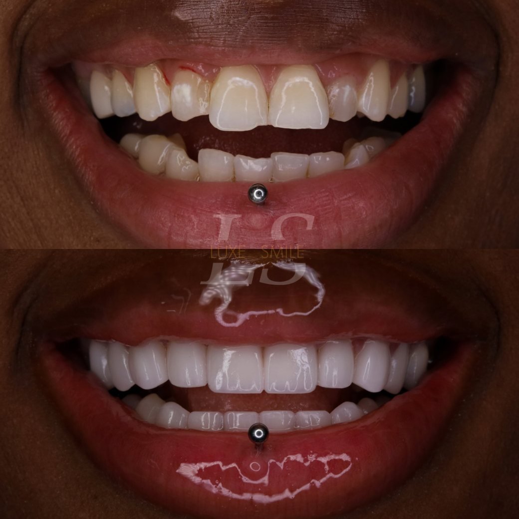 Transformation 06 — before and after